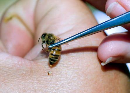 Лечение варикозная укусами пчел thumbnail