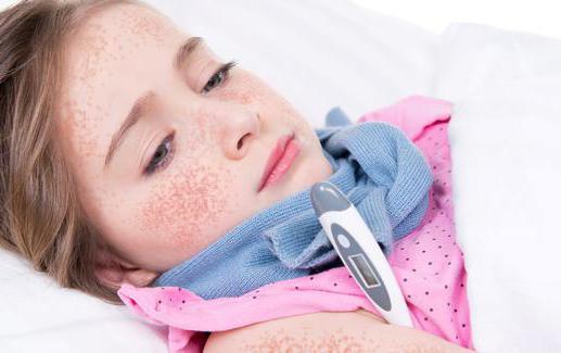 symptoms of scarlet fever in adults