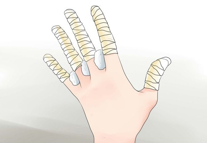 Обморожение рук лечение в thumbnail