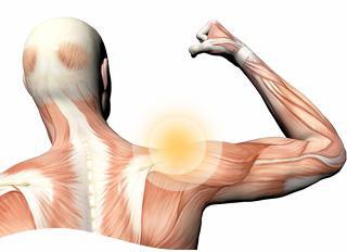 плексопатия плечевого сплетения
