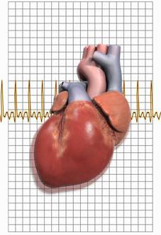 кардиосклероз сердца симптомы 