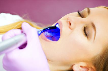 герметизация фиссур постоянных зубов