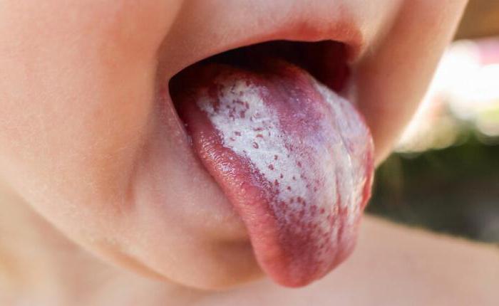Сыпь на языке у ребенка причины 