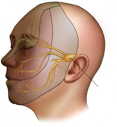 Невралгия лицевого нерва симптомы лечение