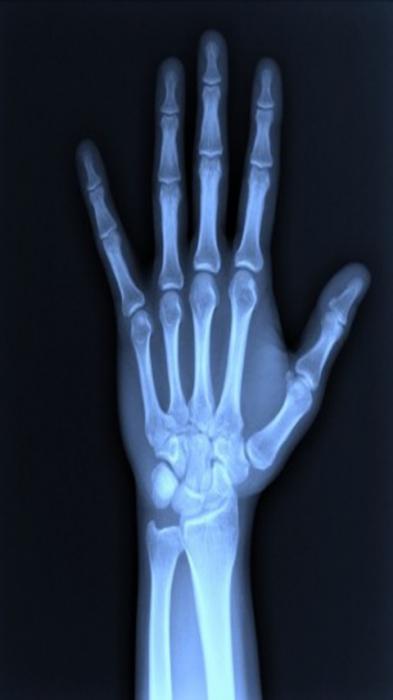 Цифровой рентгеновский аппарат 