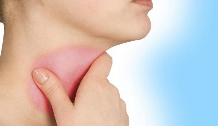 Как лечить красное горло без кашля thumbnail