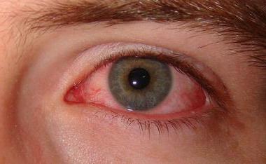 противоаллергические глазные капли для детей 