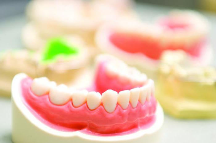 протезирование зубов виды какой 