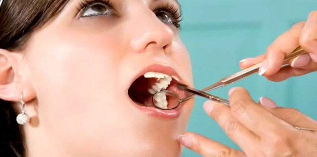 лечение после удаления кисты зуба 