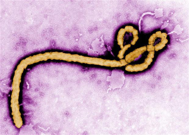 Вирус Эбола. Фото
