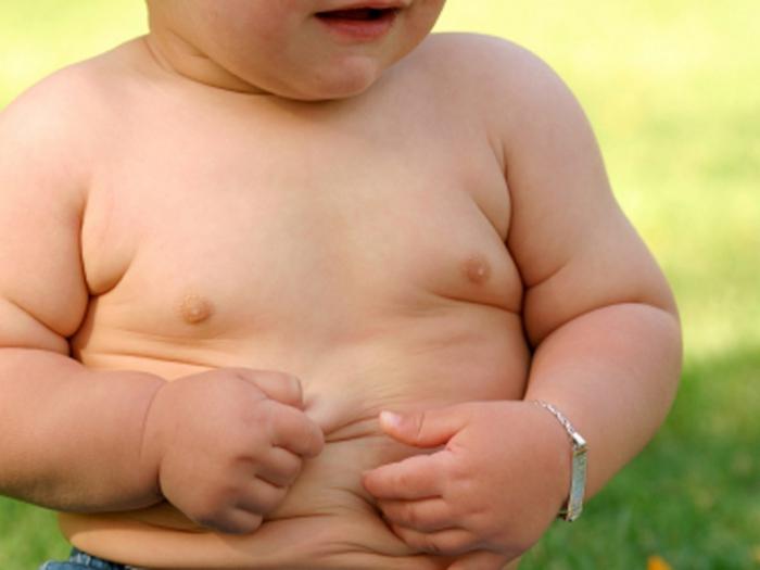 ожирение у детей фото 
