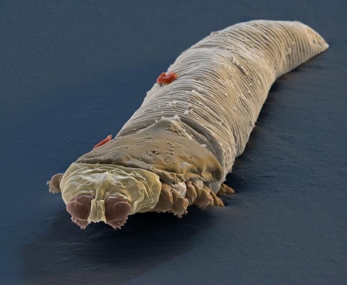 demodex eye treatment