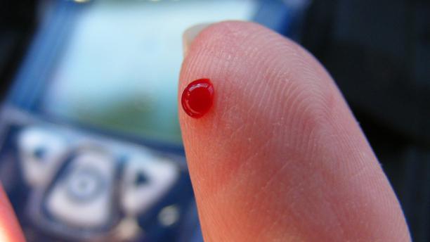 Анализ крови из пальчика правила thumbnail