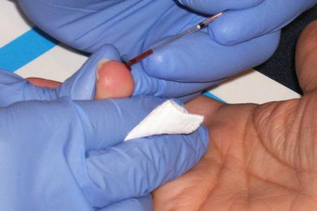 Как подготовиться к сдаче анализа крови из пальца thumbnail