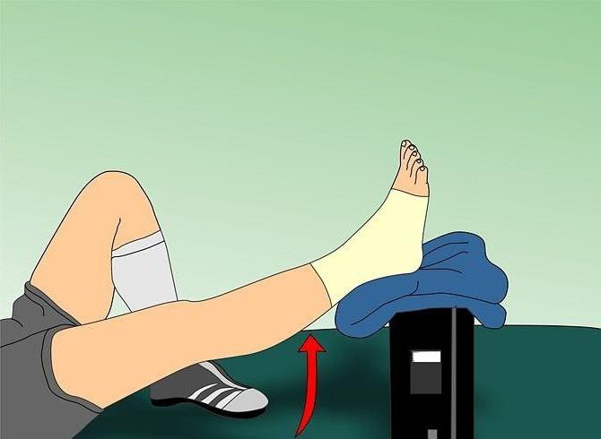 лечение сухожилий ног