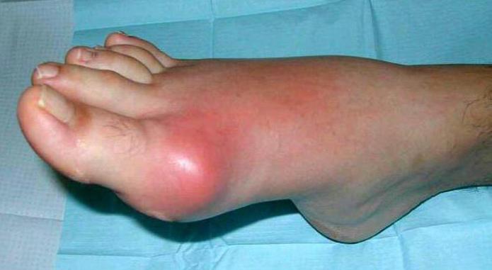 болезни ног у людей и их лечение