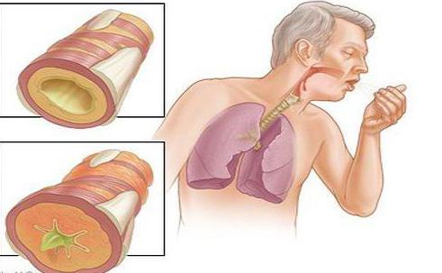 как вывести из легких мокроту