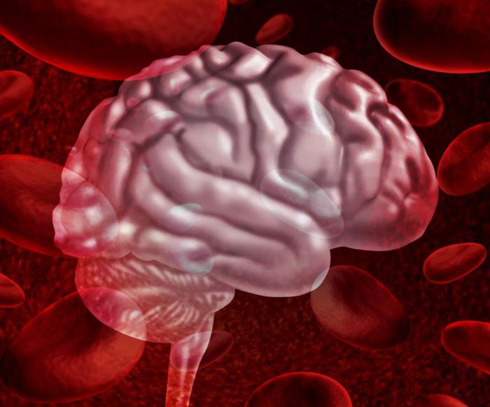 кровоизлияние в мозг симптомы