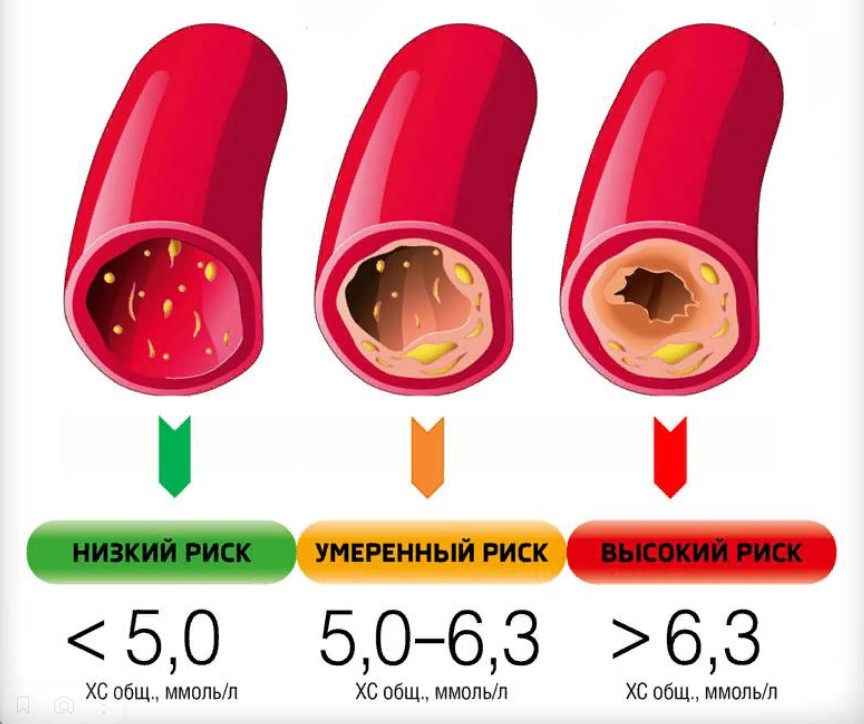 общий холестерин повышен