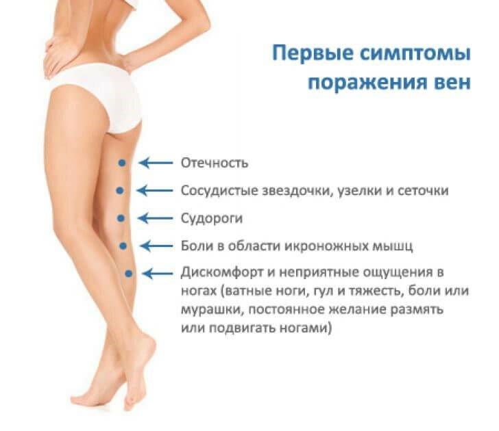 Почему у женщин ноги сильнее. Симптомы варикозного расширения. Варикозное расширение вен на ногах симптомы. Варикоз первые проявления.