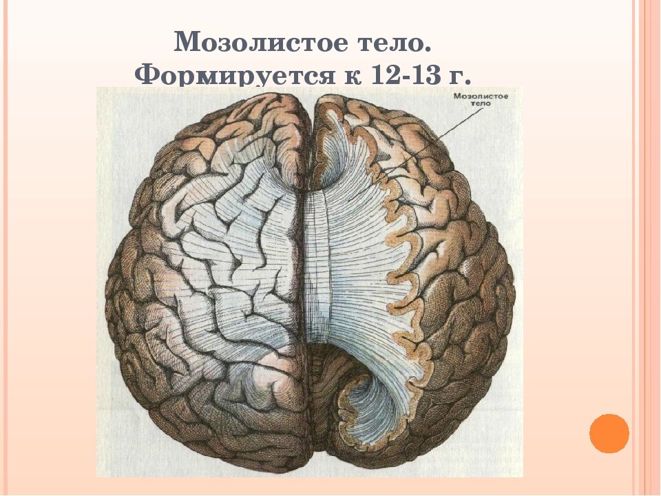 Мозолистое тело какая ткань. Мозолистое тело головного мозга. Строение мозолистого тела головного мозга. Передний мозг мозолистое тело. Полушария головного мозга мозолистое тело.