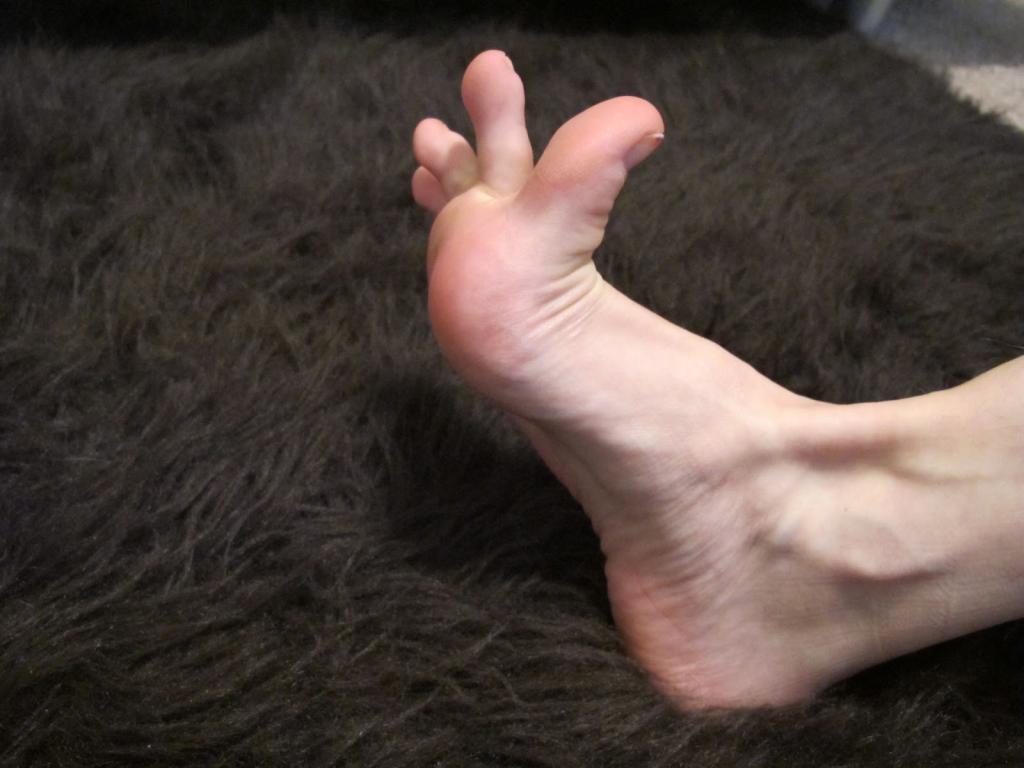 Судороги стопы и пальцев ног. Пальцы ног сводит судорогой.