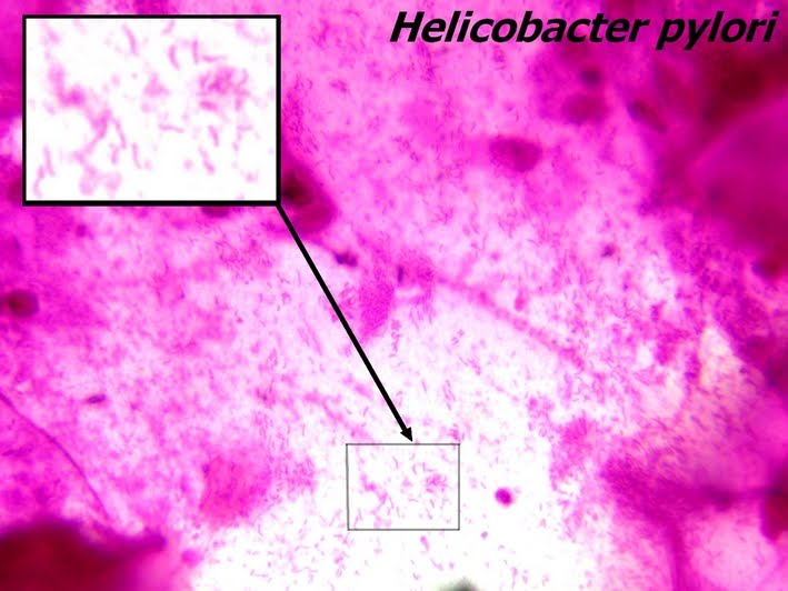 Хеликобактер пилори под микроскопом