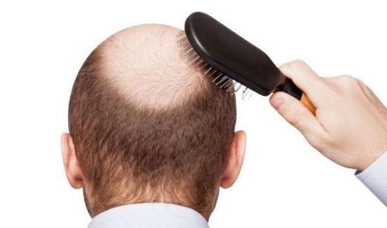 Средство «Регейн» для волос: отзывы, инструкция, применение и .