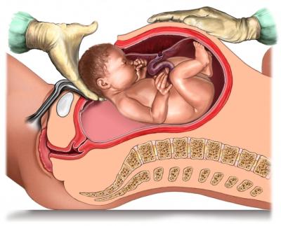 Анализ на определение группы крови ребенка во время беременности thumbnail