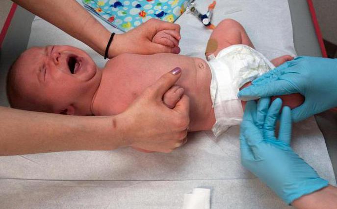 церебральная ишемия 2 степени у новорожденных симптомы и лечение