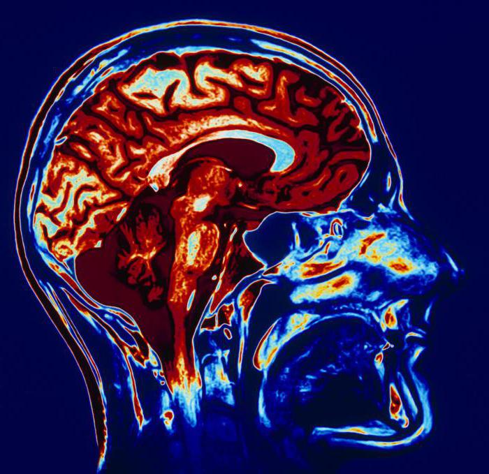 МРТ головного мозга как проходит процедура