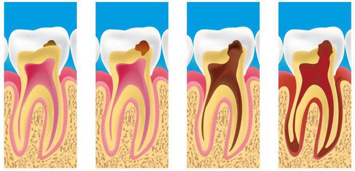 EDI values ​​in dentistry