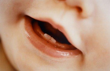 в чем суть серебрение молочных зубов у детей