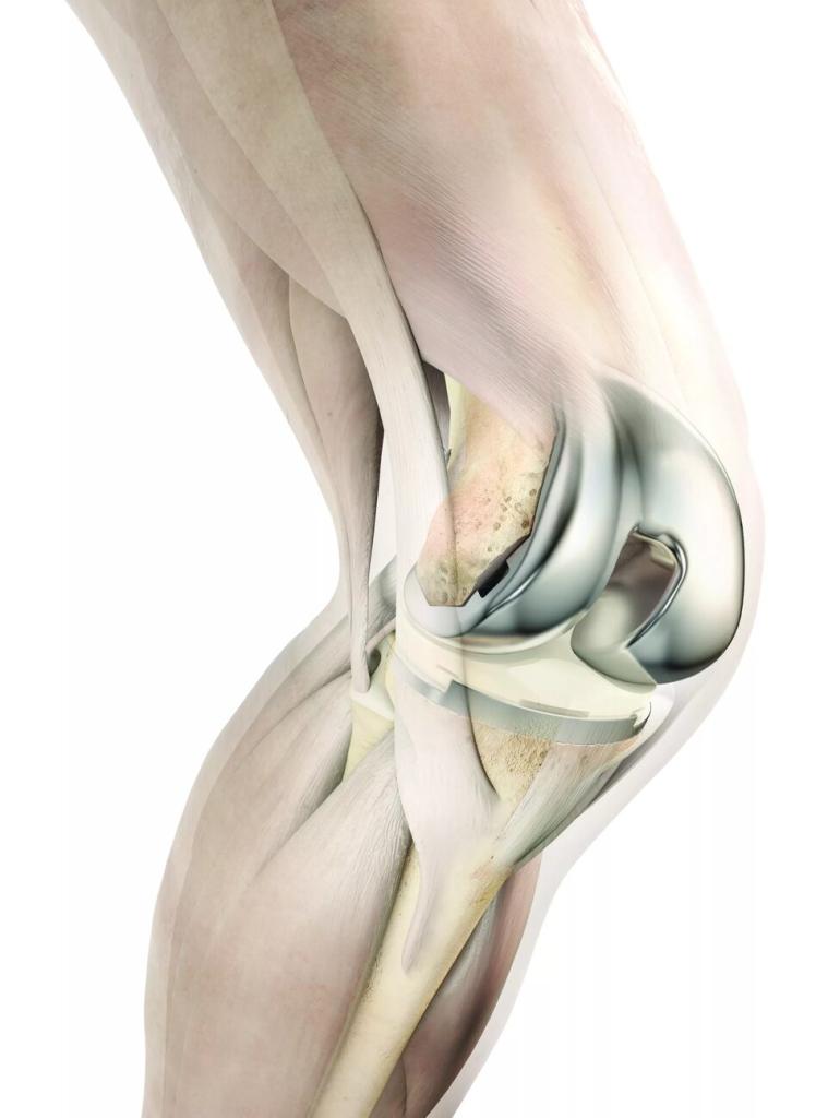 Коленный сустав. Коленный. Коленный сустав человека. Сустав колена. Внутри коленный сустав
