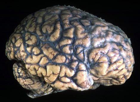 medial surface of the brain