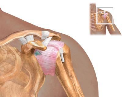 Мышцы ключица плечевой сустав thumbnail