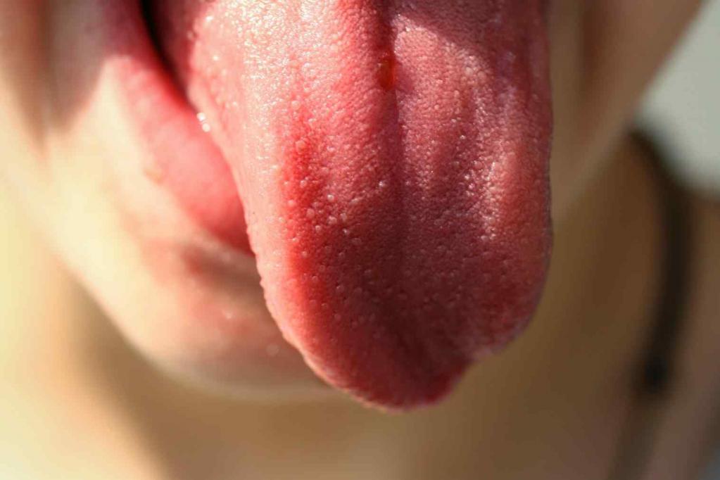 Воспаление в полости рта