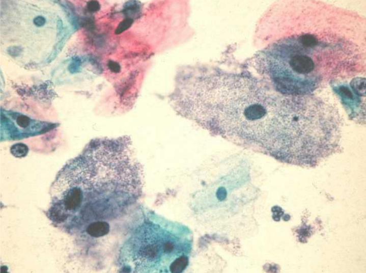 Бактерия под микроскопом