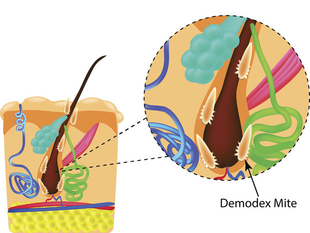 Клещи рода демодекс