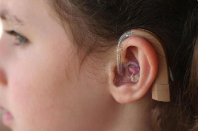 восстановление слуха у детей