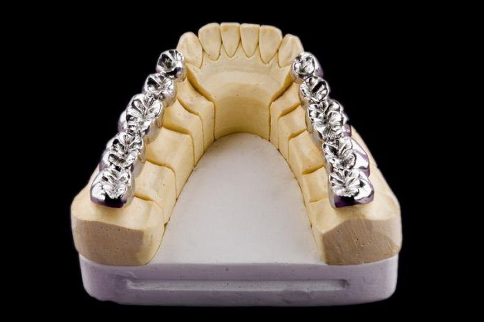 металлические коронки на зубы 