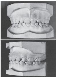зубная формула человека