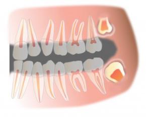 Строение челюсти человека зубы