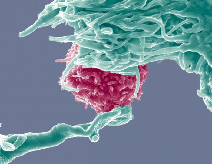 лечение рака дендритными клетками