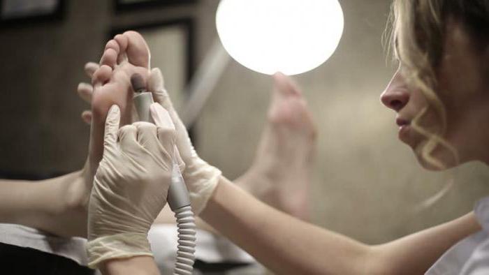 Мозоль между пальцев ног лечение народными средствами thumbnail