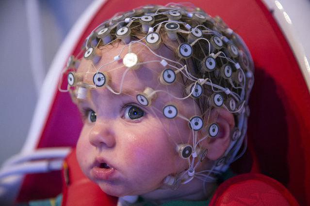ээг головного мозга у детей как проходит и зачем