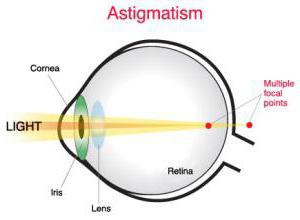 астигматические контактные линзы