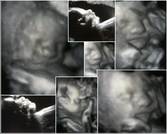 19 недель беременности на узи фото