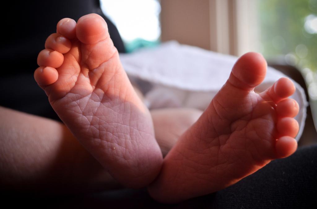 мацерация кожи у новорожденных