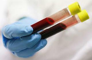  алт и аст анализ крови расшифровка